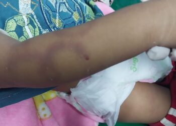 Una bebé de un año de edad murió golpeada y violada.