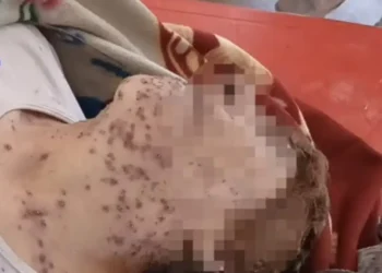 Una mujer de la tercera edad falleció tras ser atacada por un enjambre de abejas. FOTO: Captura
